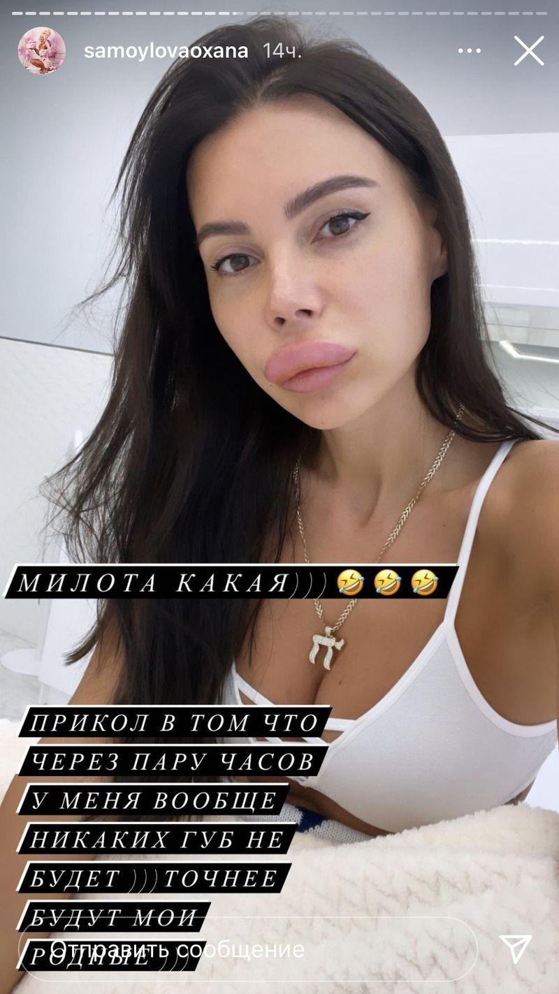 Бизнесвумен показала сильный отек