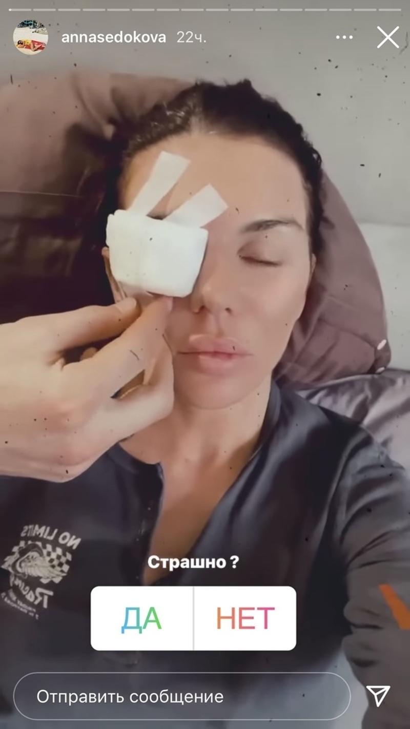 Певица сделала операцию на глазу