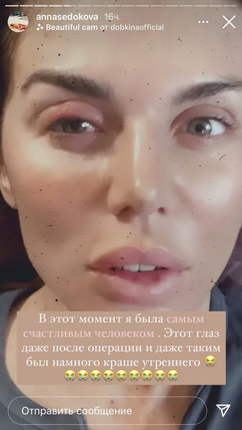 Артистка из-за проблем со здоровьем перенесла съемки и не смогла прийти на светские мероприятия