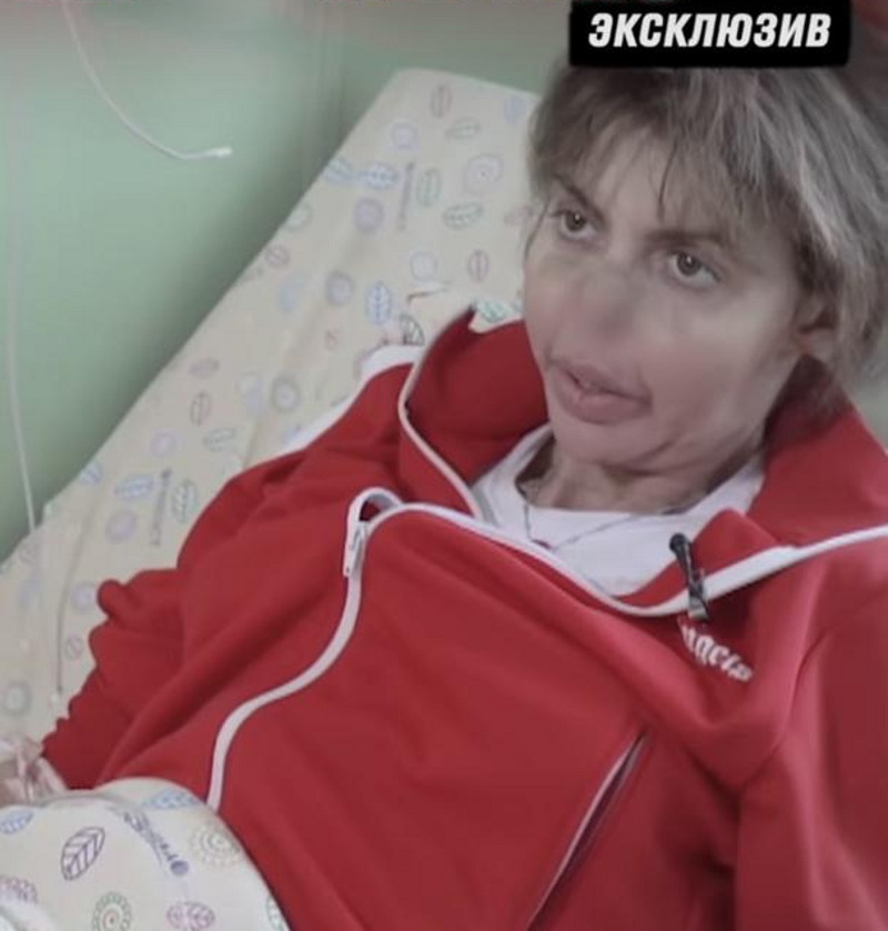 Малахов показал тяжелобольную экс-супругу Аршавина