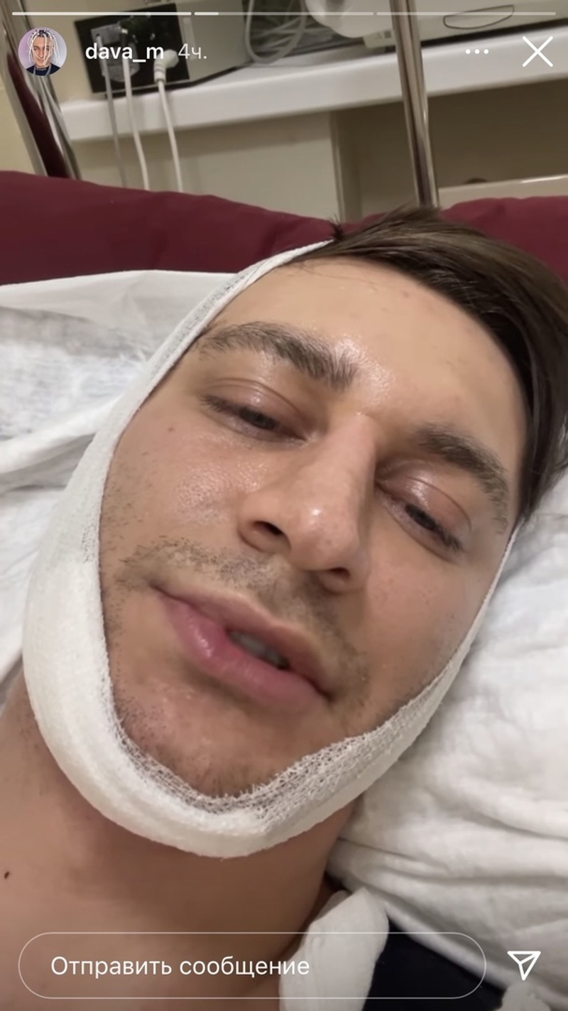 Артист показал себя после операции