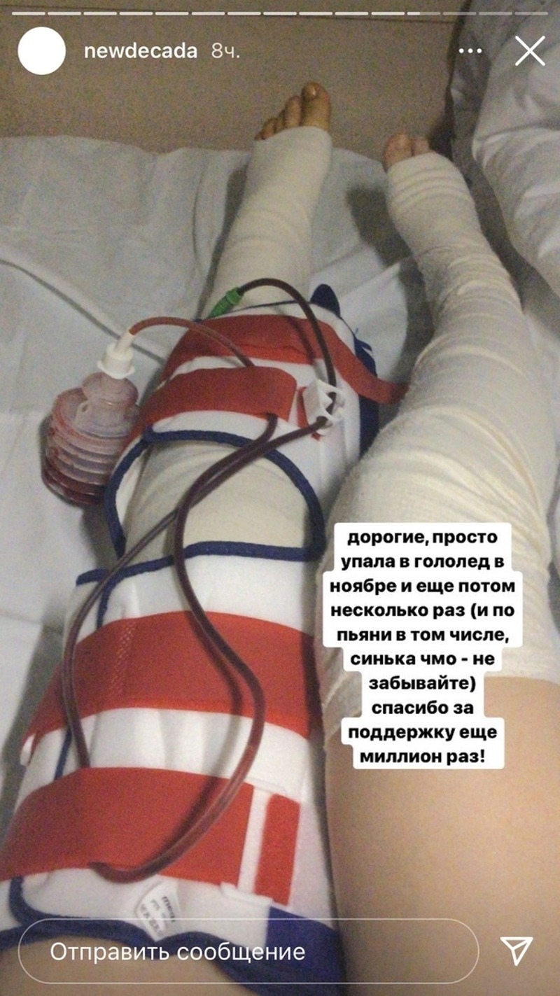 Девушке прооперировали ногу