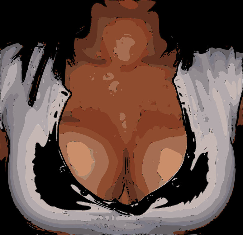 Можно ли исправить форму ареолы и соска