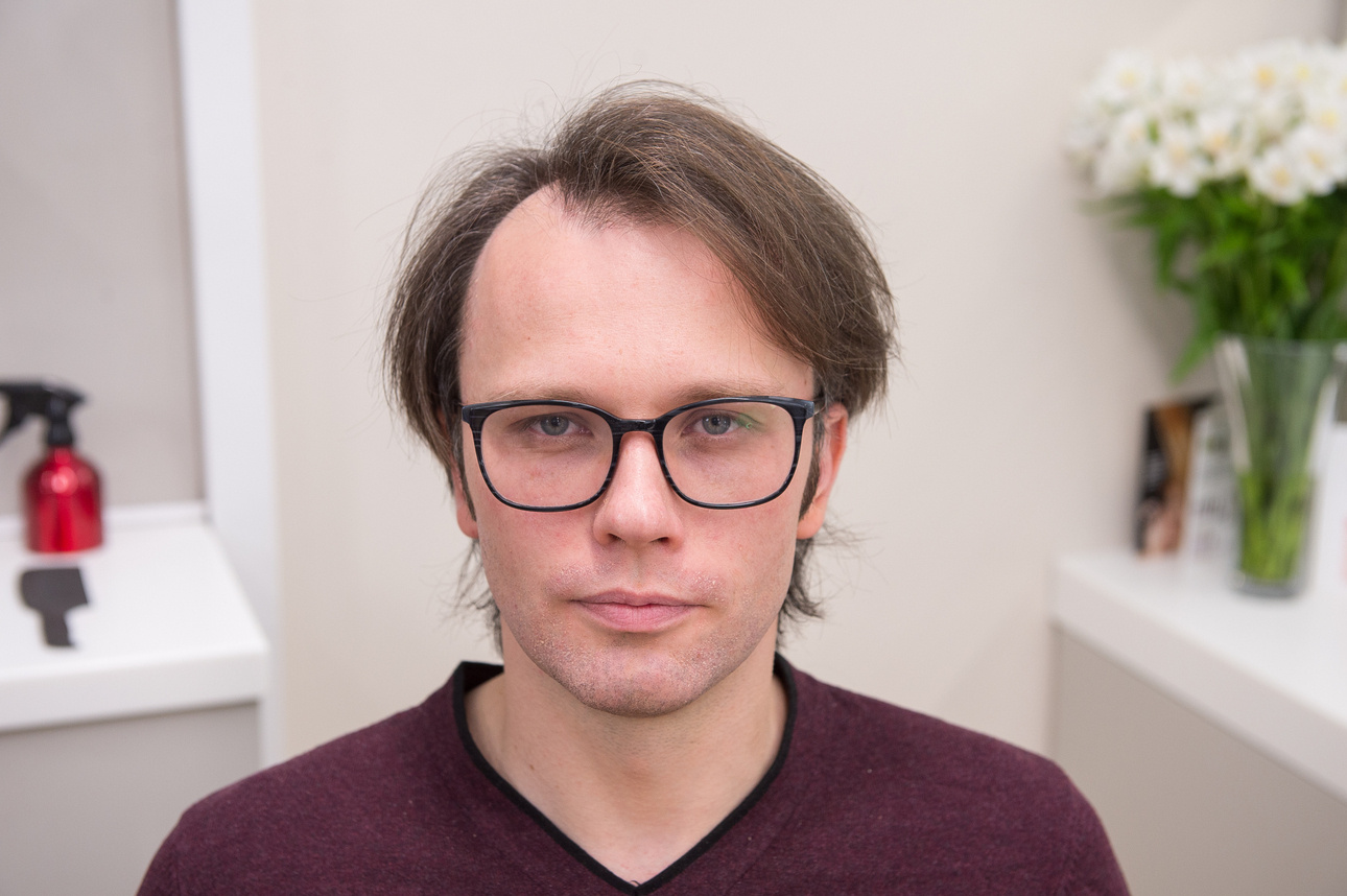 определяем форму головы