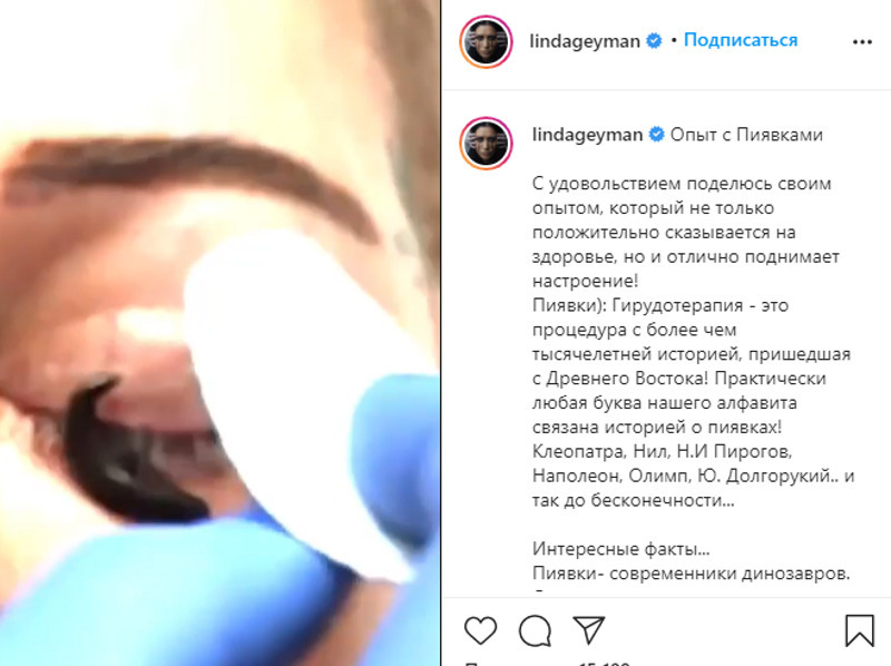 Линда ставит пиявки на глаза