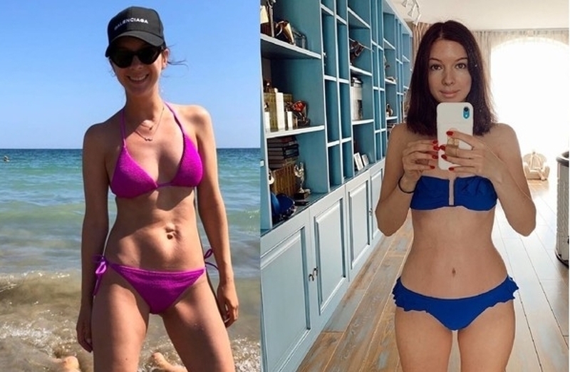 Сестра Подольской сделала пластику живота