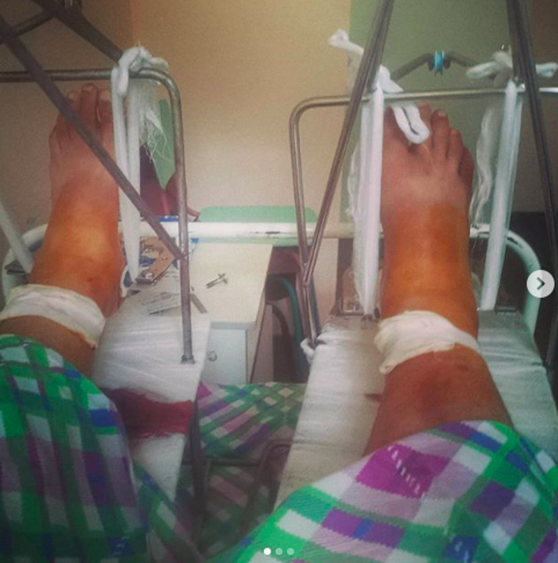 Актер опубликовал фото из клиники