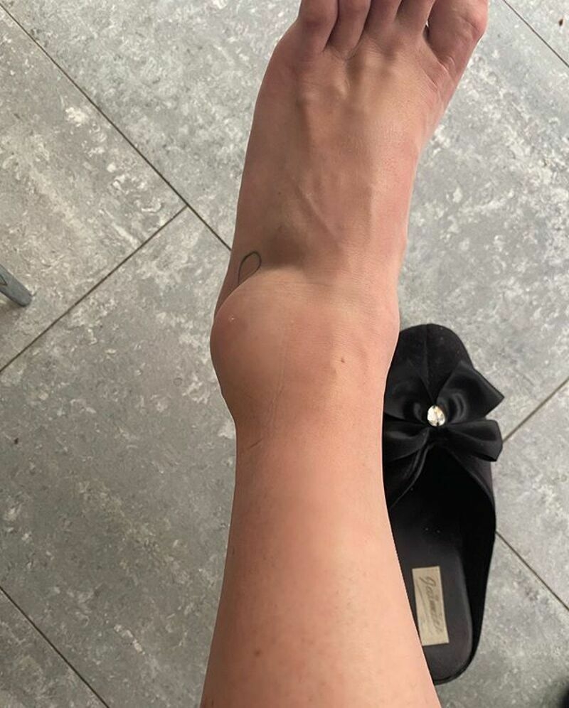 Многие травмы Анна лечит самостоятельно