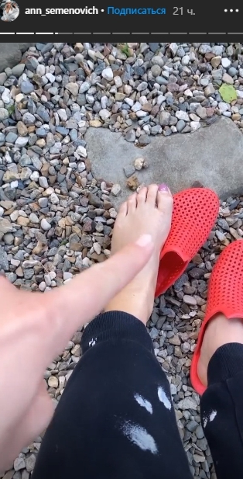 Семенович травму ноги на карантинной вечеринке