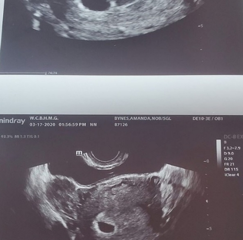 Аманда Байнс впервые станет матерью