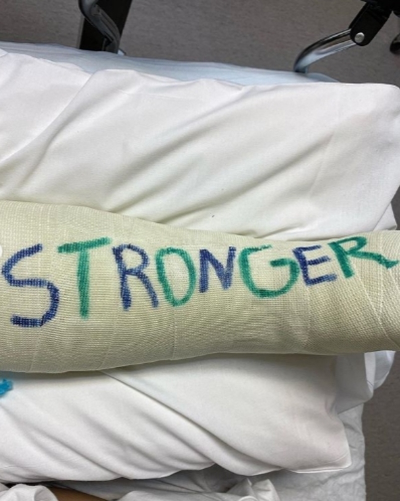 Спирс попала в больницу со сломанной ногой