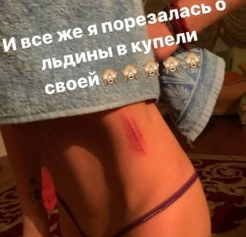 Волочкова травмировалась о льдины своей купели