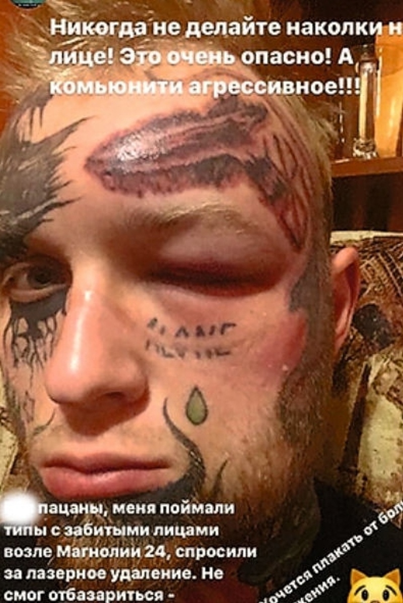 Сына Яковлевой избили из-за удаления татуировок