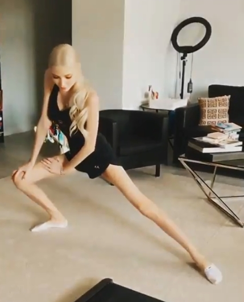 «Никто не должен соответствовать вашим о них ожиданиям!» Алена Шишкова ответила на критику своей худобы