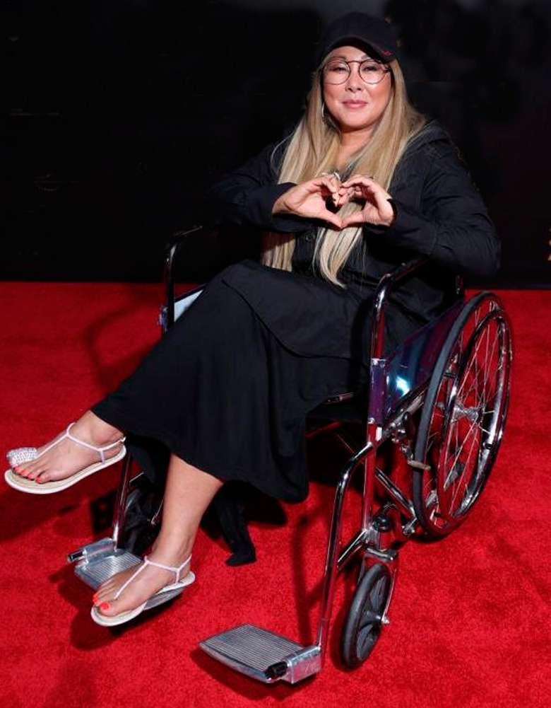 Певица Анита Цой старается не унывать после травмы