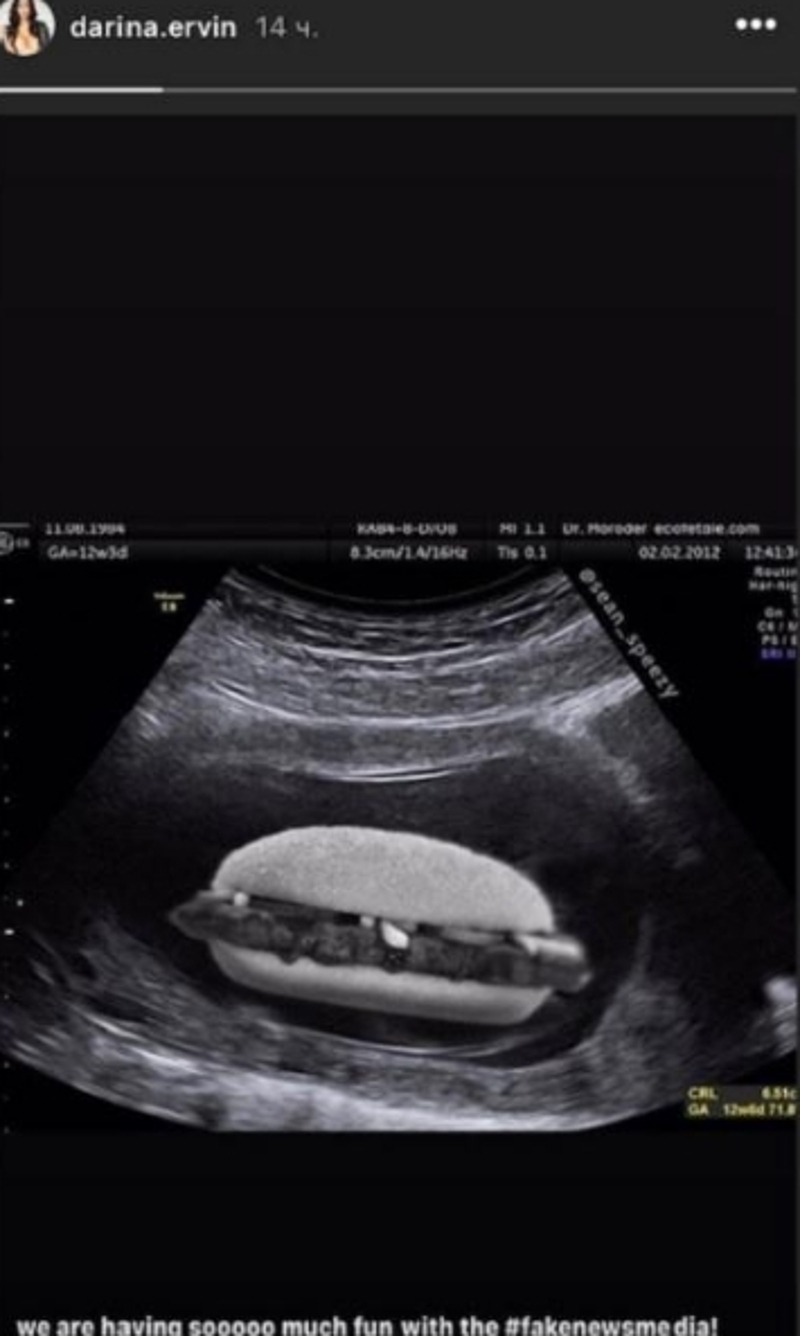 Молодая жена Цекало необычно прокомментировала беременность