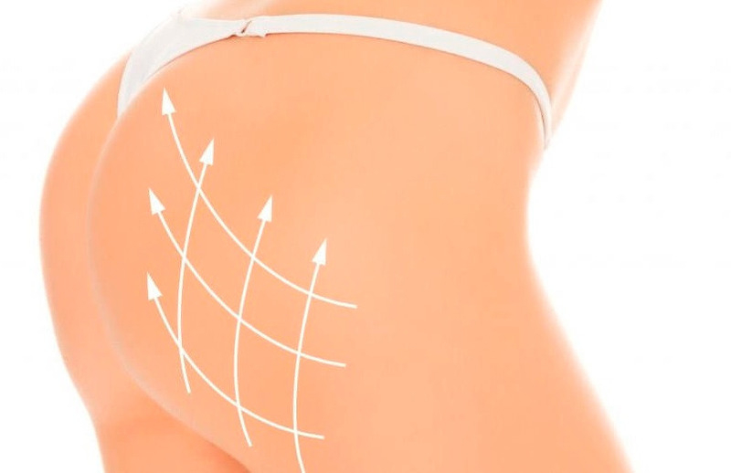 Для лифтинга ягодиц