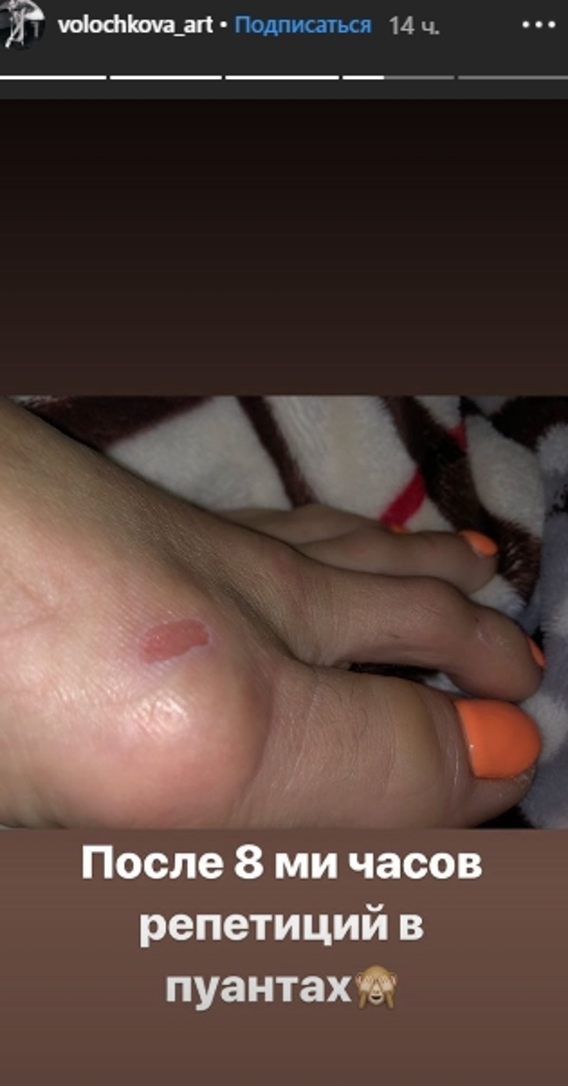 Волочкова травмировала ногу на репетиции