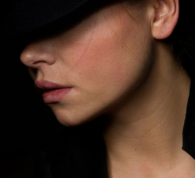 операция позволяет скорректировать овал лица