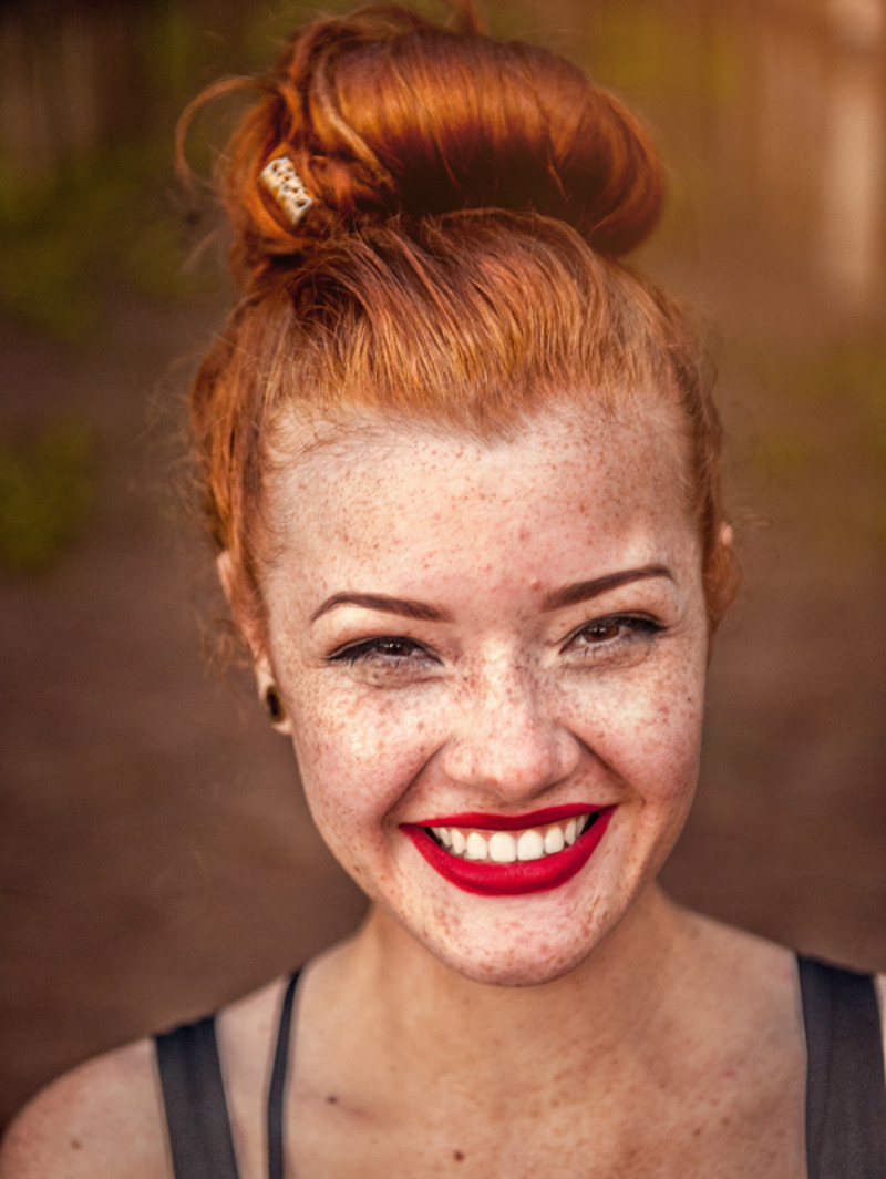 Пигментация и купероз? Используйте витамин К