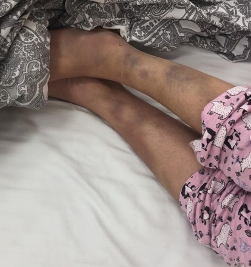 МакSим серьезно пострадала в ДТП