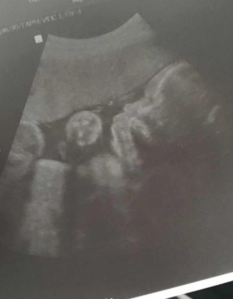 Милана Тюльпанова поздравила сына с днем рождения