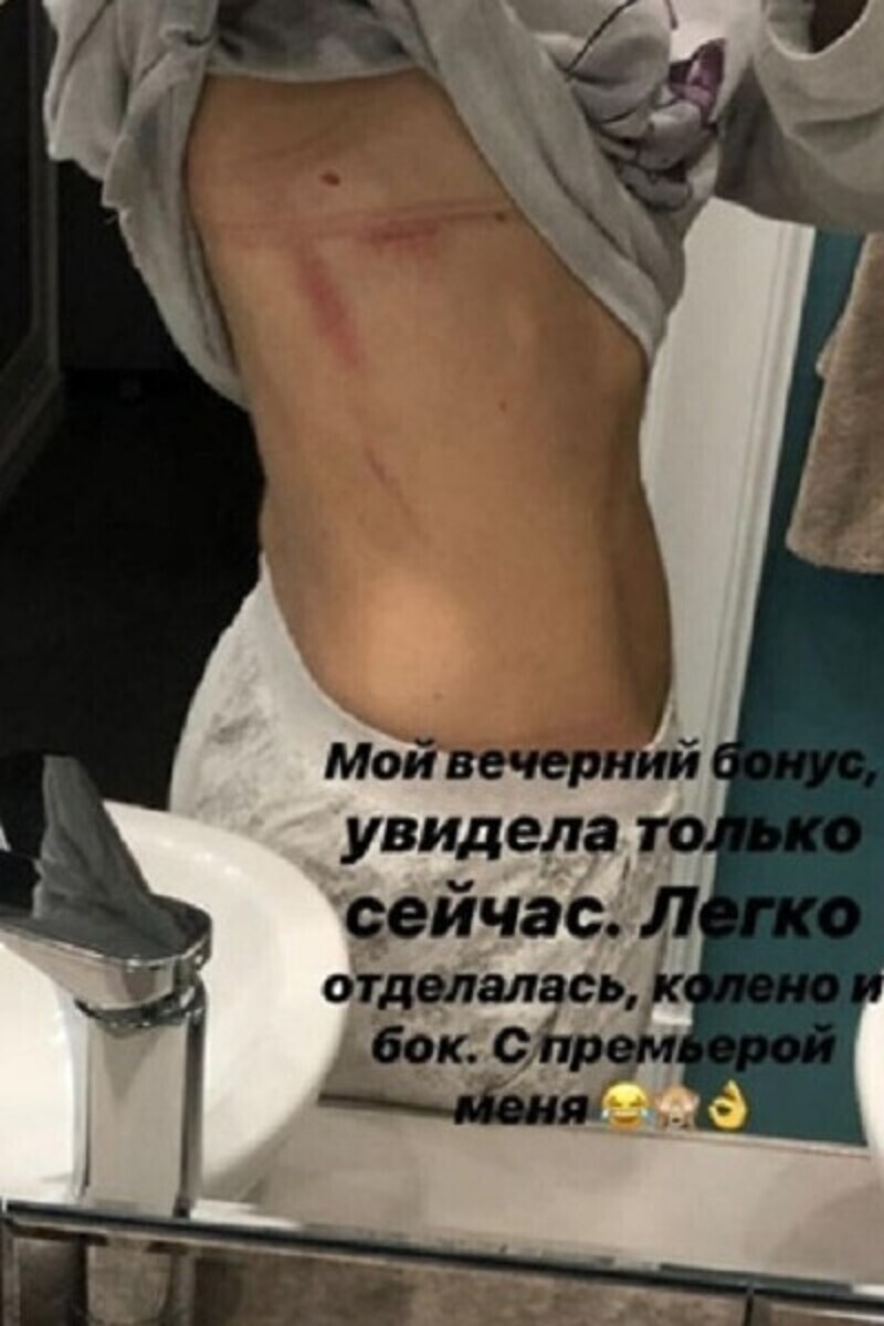 Травмы оказались болезненными