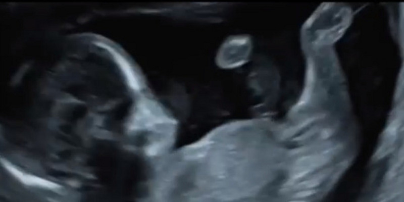 УЗИ, которое Нюша показала в своем новом клипе