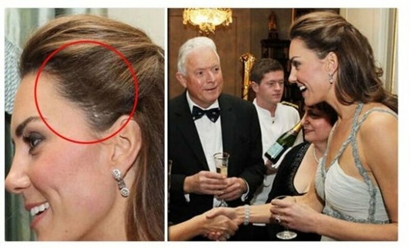 Фото со шрамом облетело Сеть