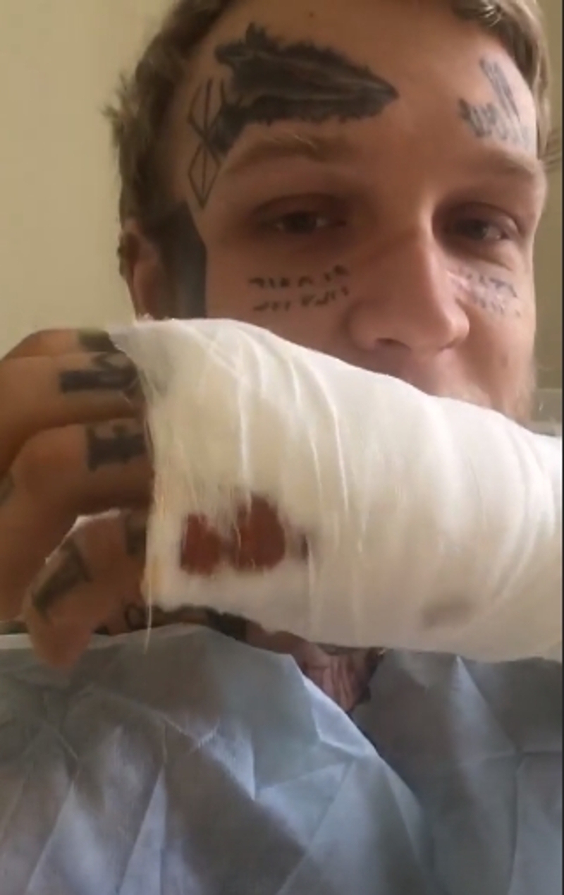 Сыну Елены Яковлевой провели операцию в присутствии кота