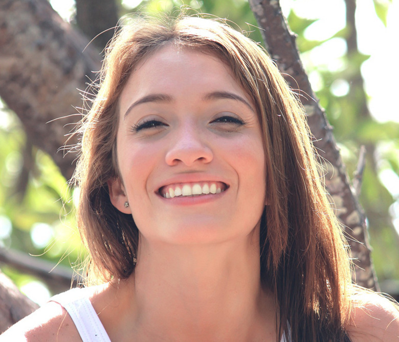 Зачем нужны виниры?