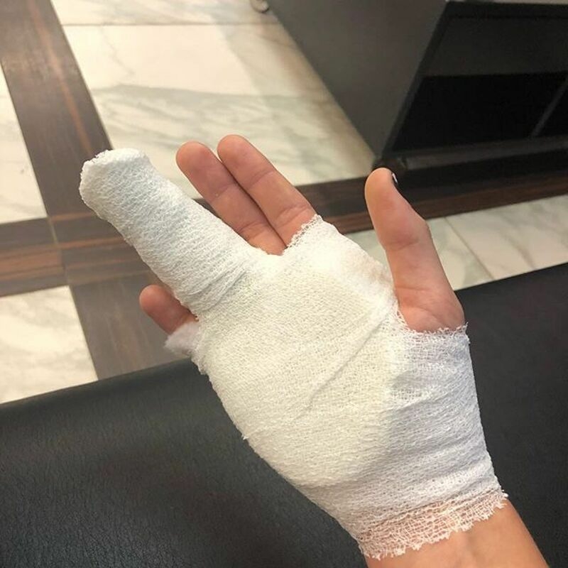 Тренировка закончилась травмой