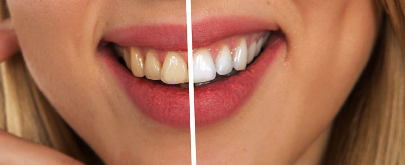 Зато результат работы стоматолога видно сразу