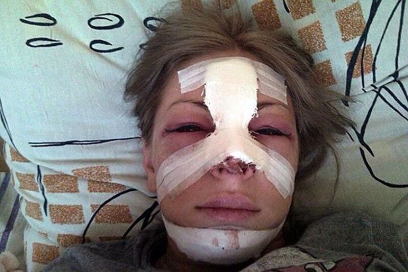 Саша Project в клинике