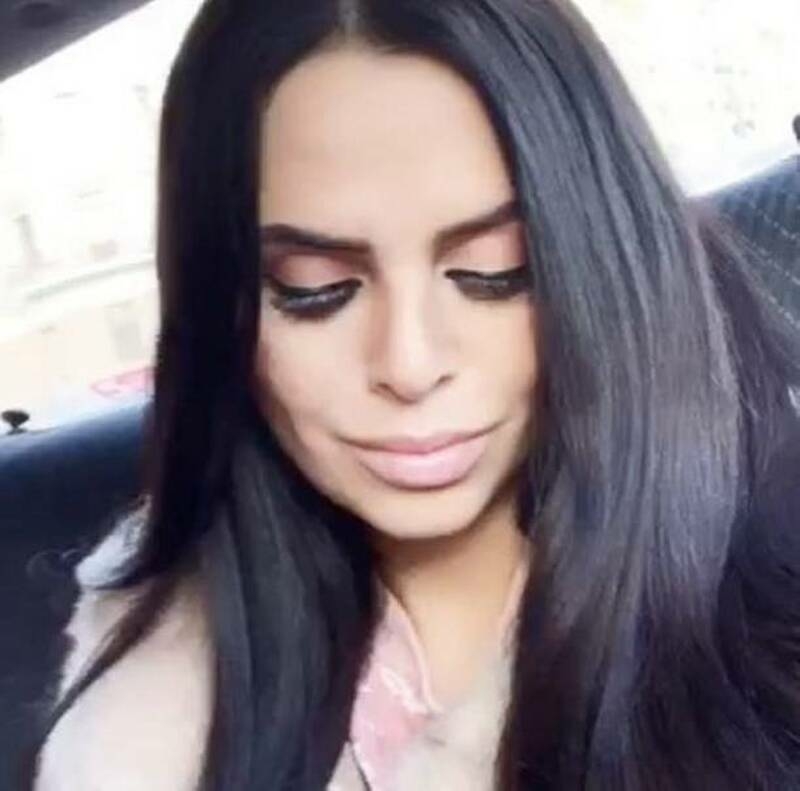 Подписчики обвинили Романец в нарочитой ненатуральности