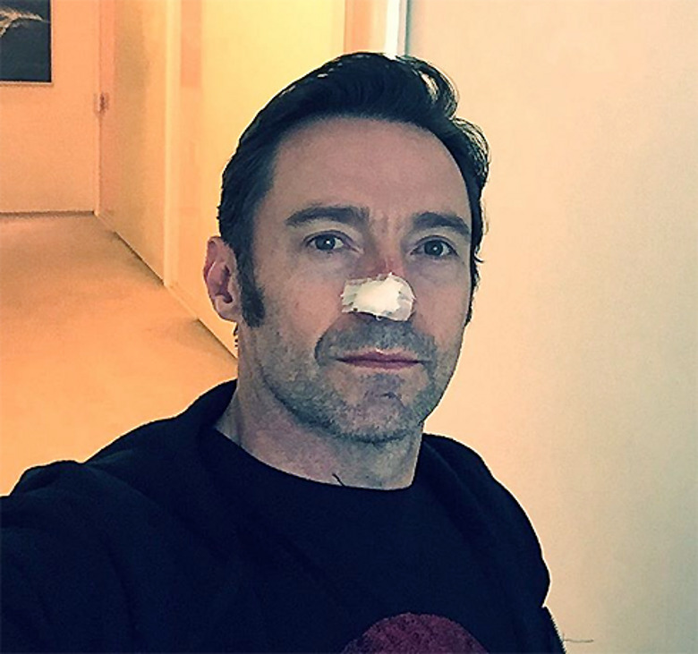 Хью Джекман 