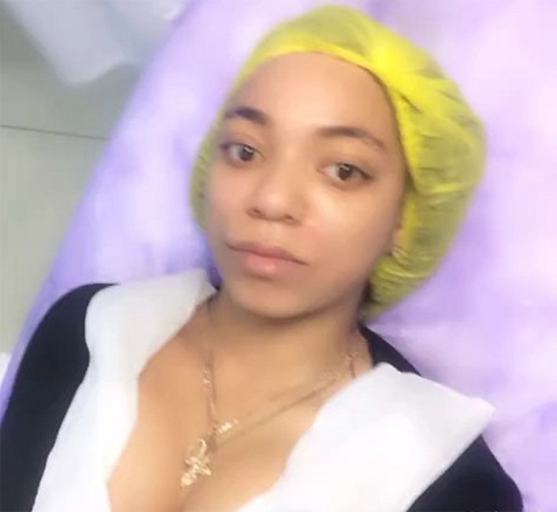 Брюнетка убрала двойной подбородок без операции