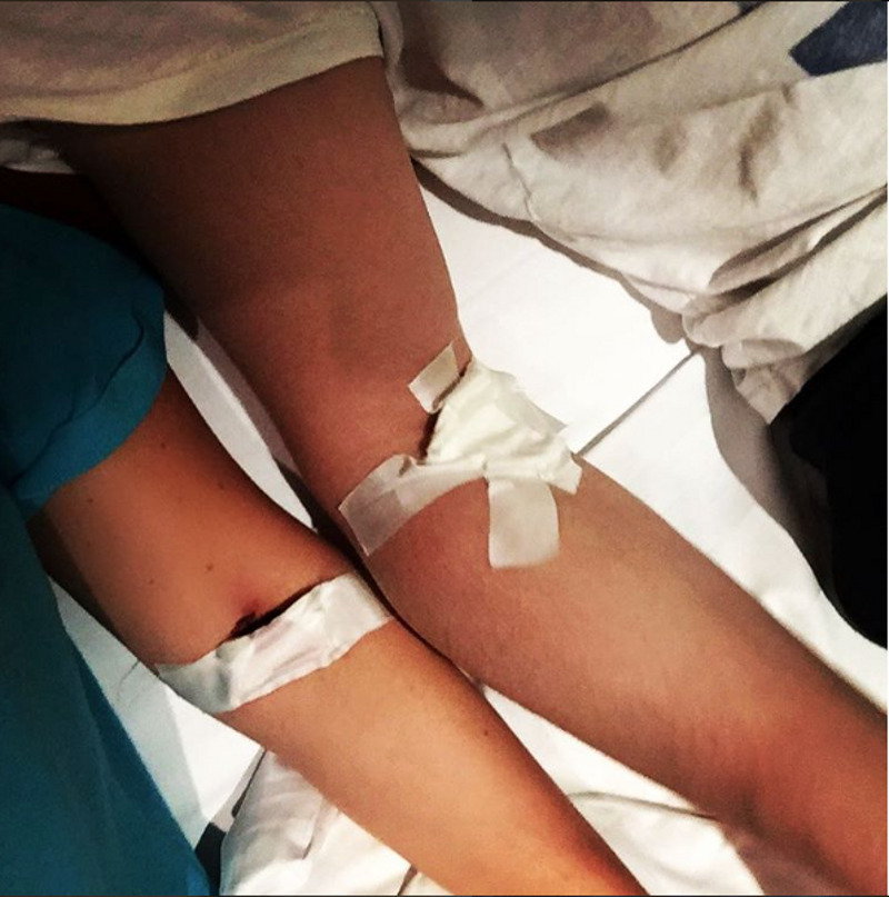 Лера и Игорь проходят обследование в Германии