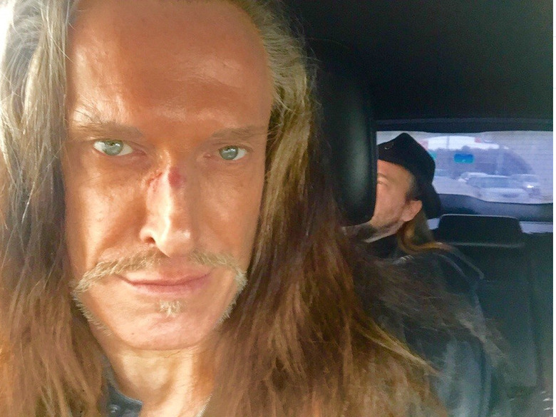 Джигурда после драки с охранниками адвоката