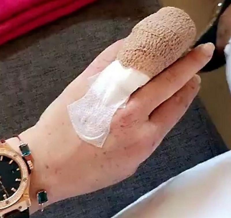 Линдсей Лохан едва не осталась без пальца