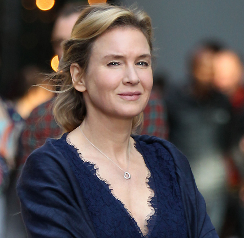 Пластический хирург Светлана Пшонкина считает, что Рене все же сделала пластическую операцию