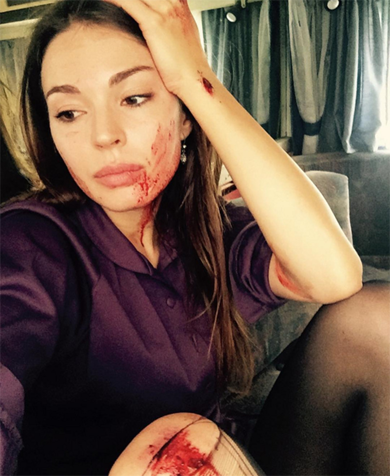 Актриса шокировала своим лицом