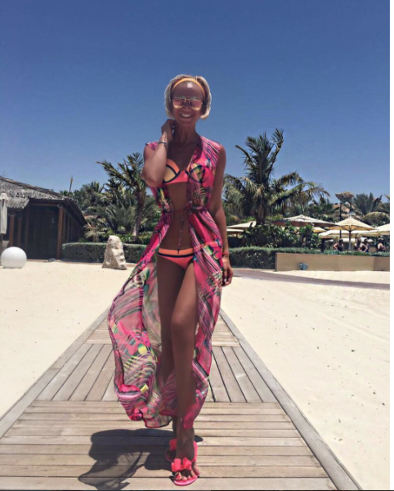 Поклонники беспокоятся за здоровья Бузовой из-за чрезмерно темного загара