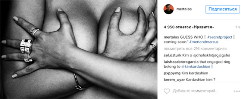 Фотограф Мерт Алас предложил угадать, чья это грудь