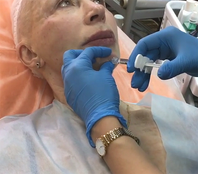 Актриса мужественно вытерпела болезненную процедуру