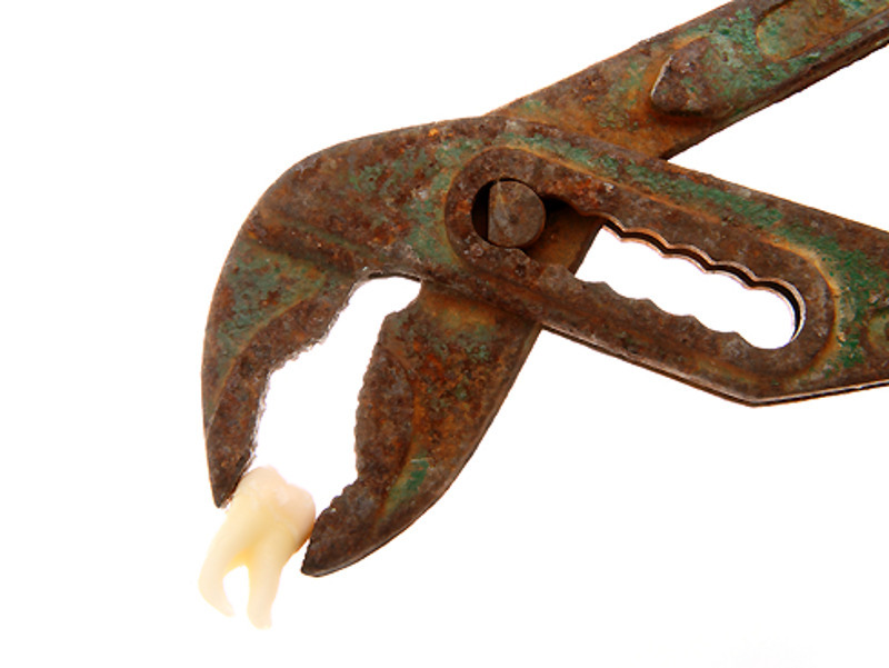 В средние века удалять больные зубы запрещалось