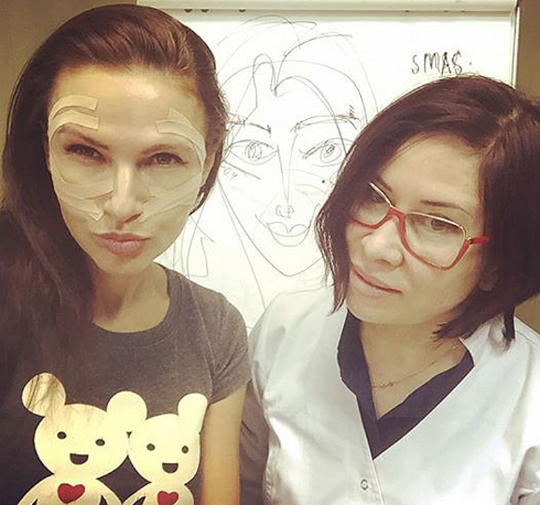 Эвелина Бледанс сделала подтяжку лица