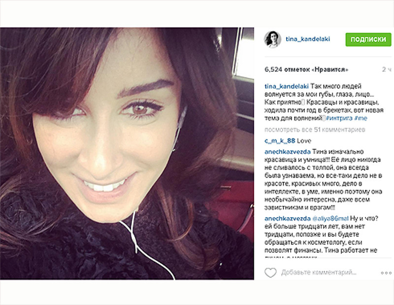 Тина Канделаки призналась, что носила брекеты