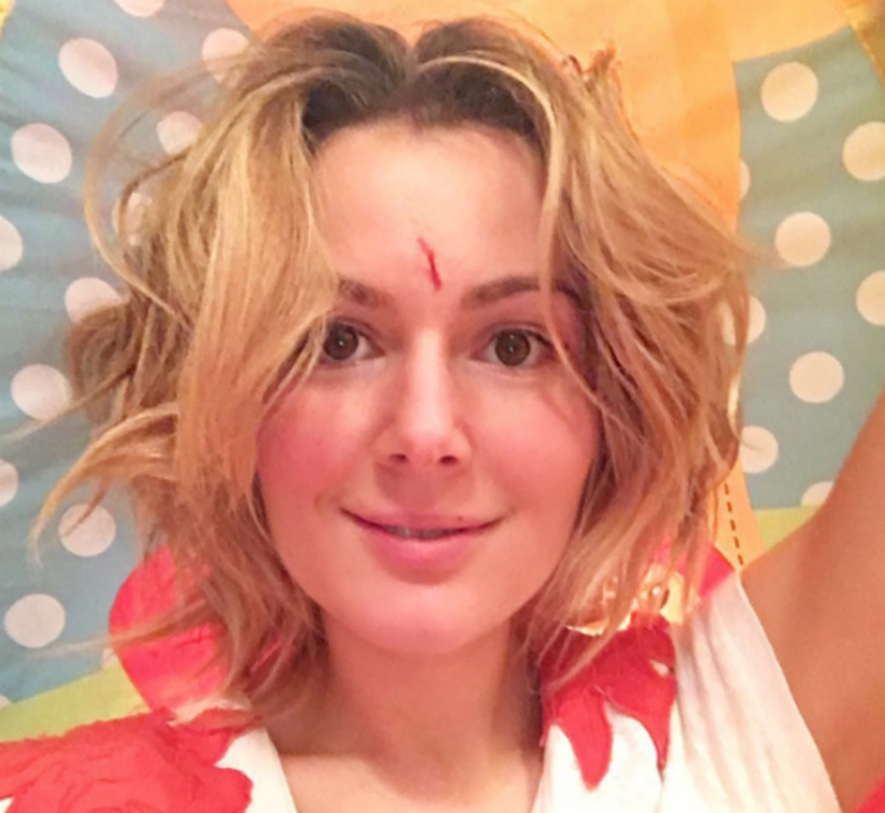 Мария Кожевникова получила глубокую царапину, играя с сыновьями