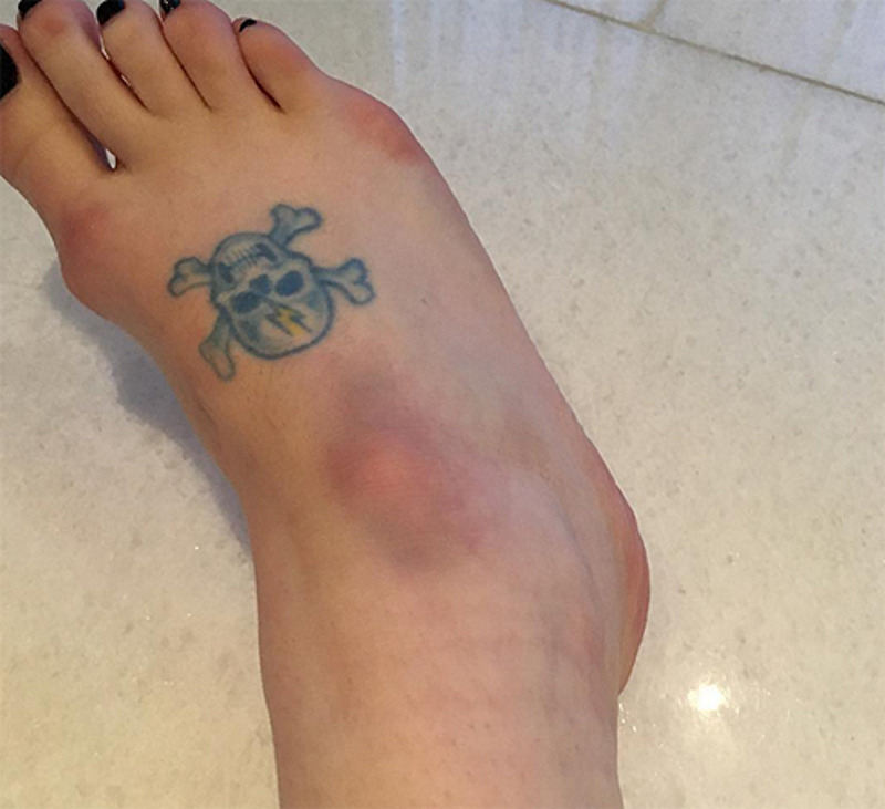 «Все, что я хочу на Рождество — чтобы у меня не была сломана нога», - так подписала этот кадр Келли Осборн